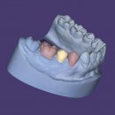 DentalCAD Dauer-Lizenz Provisional Module