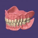DentalCAD Dauer-Lizenz FullDenture Module
