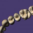 DentalCAD Flex-Lizenz ZRS Tooth Library