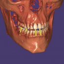 DentalCAD Flex-License DICOM Viewer