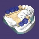 DentalCAD Flex-Lizenz PartialCAD Module