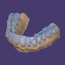 DentalCAD Flex-Lizenz Bite Splint Module