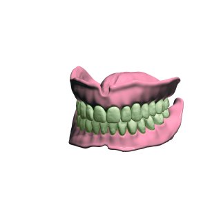 Full Dentures Add-on