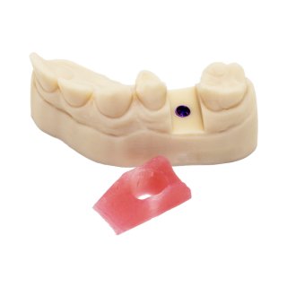 Zahnfleischmasken Material 3D Druck