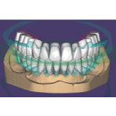 DentalCAD Dauer-Lizenz FullDenture Ivotion Add-On...